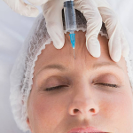 Botox maseter: secretul pentru o față mai subțire și mai relaxată